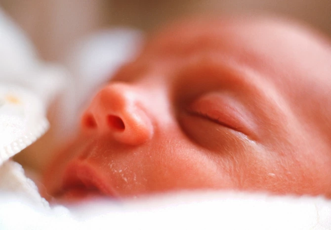 Šok U Porodilištu: Rođena Je Beba Sa Repom Od 6 Cm – Koji Nije Prestao Da Raste