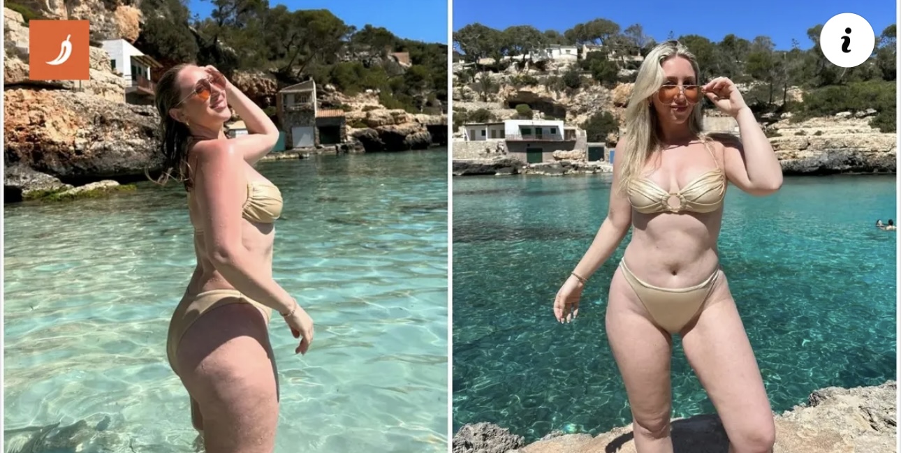 Objavila fotke u bikiniju pa postala viralna, ljudi pišu: Ovako izgleda žensko tijelo